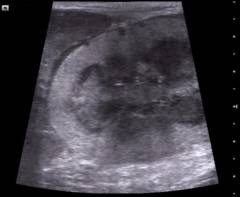 Ultrasound Image